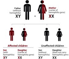 hemophilia B gene therapy