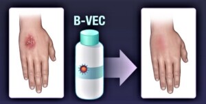 topical gene therapy