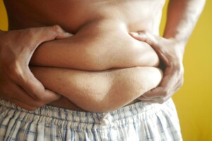 Genetic treatment of Obesity